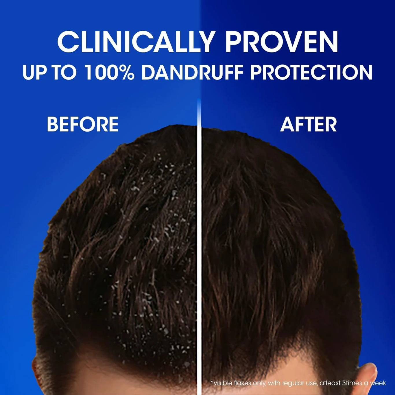 Anti Dandruff Shampoo Cool Menthol For Men & Women